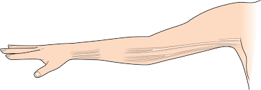 3 Things to Improve Axillary Web Syndrome